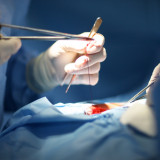 How to Ensure a Successful Tummy Tuck Recovery