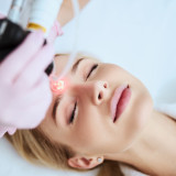 Important Things To Know About Fraxel Laser Resurfacing