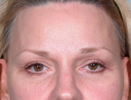 Patient Case #198 After image