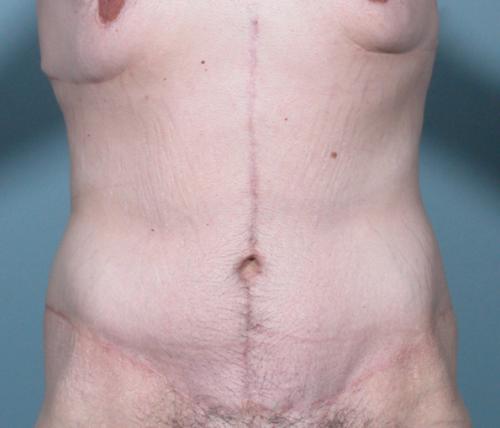 Patient Case #255 After image