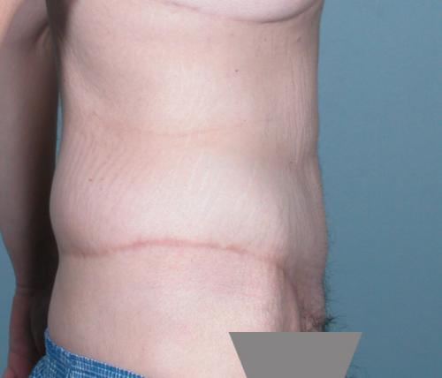 Patient Case #255 After image