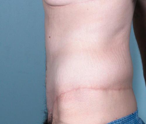 Patient Case #255 After image