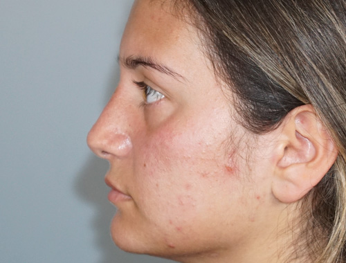 Case #585 After image