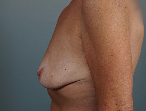 Case #564 Before image