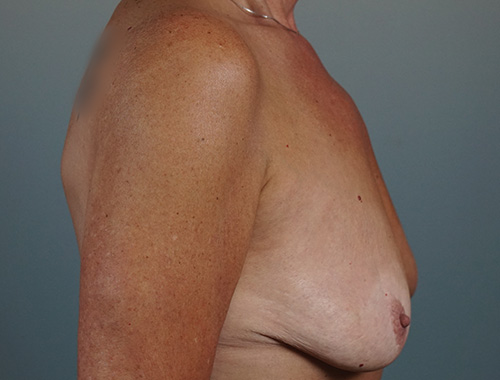 Case #564 Before image