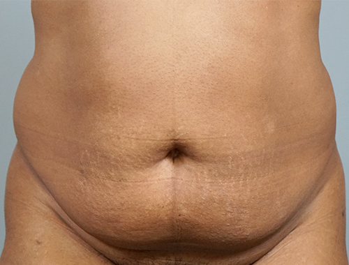 Case #678 Before image