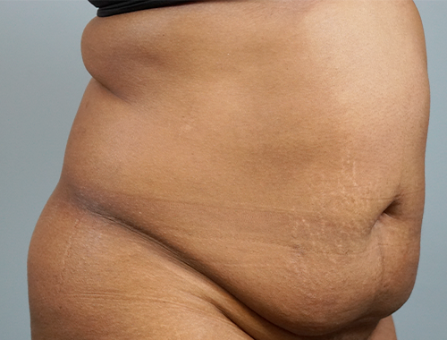 Case #678 Before image