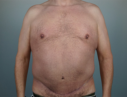 Case #668 After image