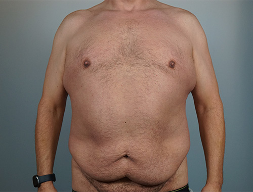 Case #668 Before image
