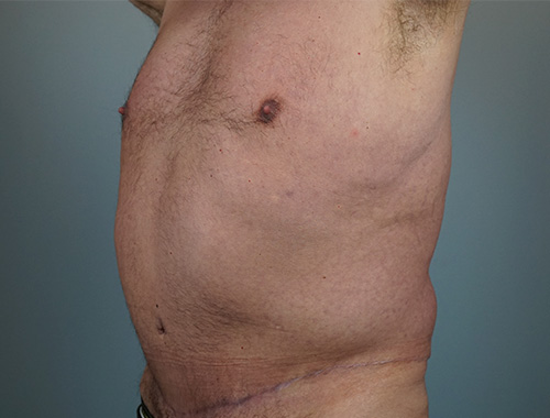 Case #668 After image