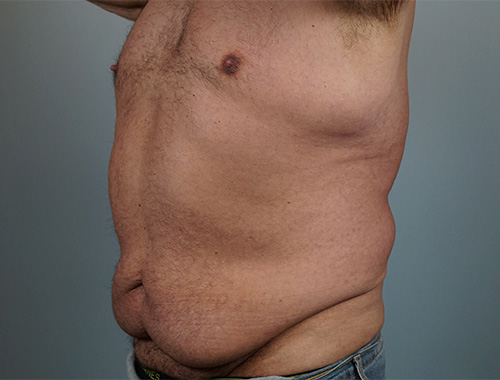 Case #668 Before image