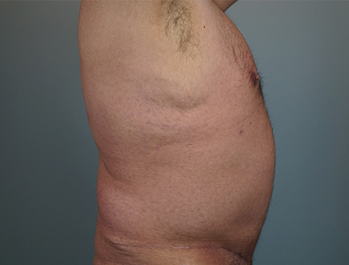 Case #668 After image