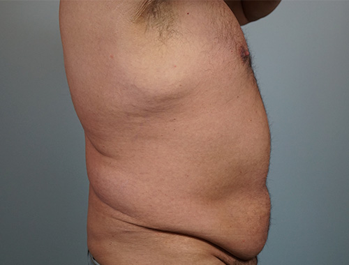 Case #668 Before image