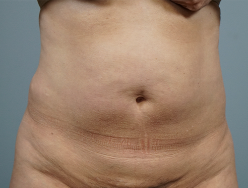 Case #676 Before image