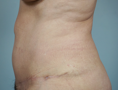 Case #676 After image