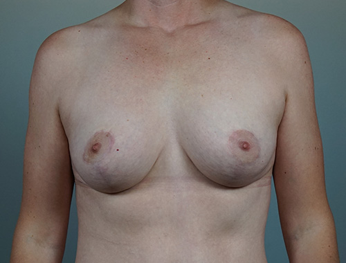 Case #673 After image