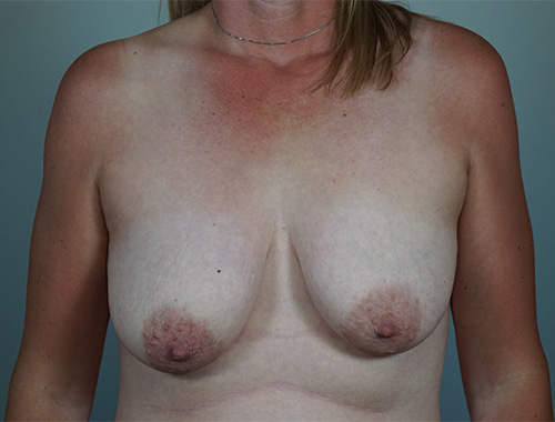 Case #673 Before image