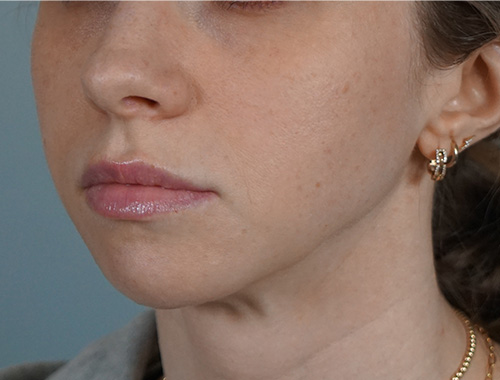 Case #666 Before image