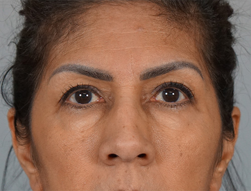 Case #667 Before image