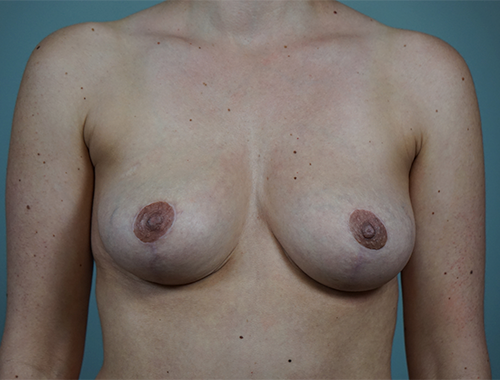 Case #669 After image