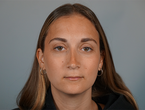 Case #665 After image