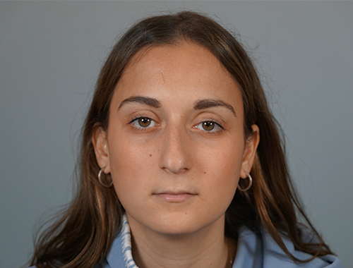 Case #665 Before image