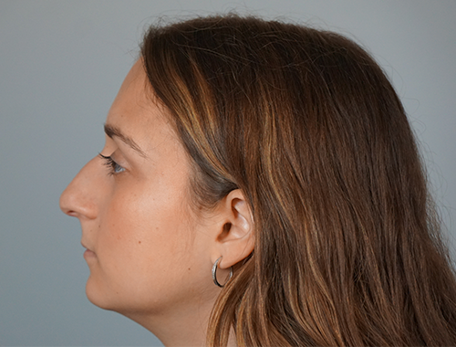 Case #665 Before image