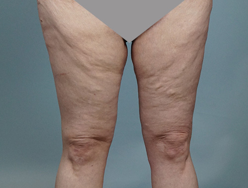 Case #672 After image