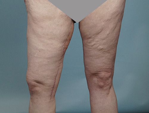 Case #672 After image