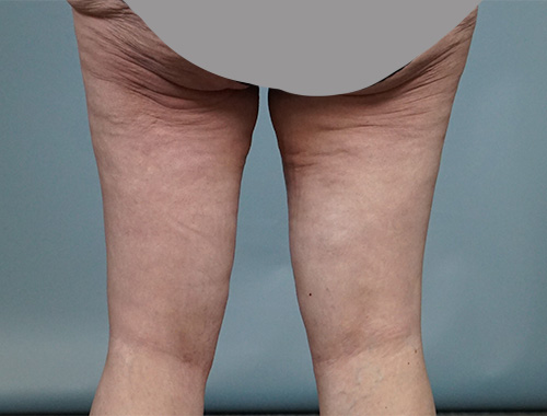 Case #672 After image