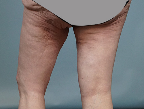 Case #672 After image