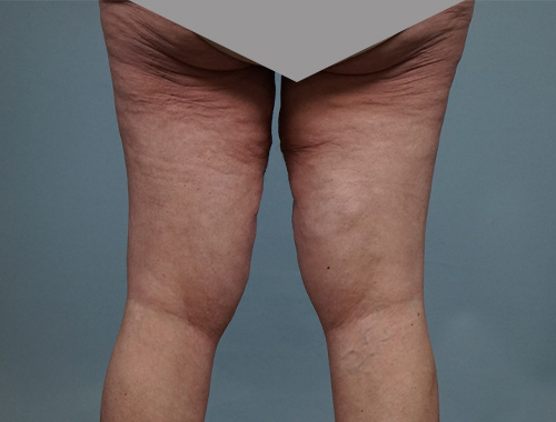Case #672 Before image