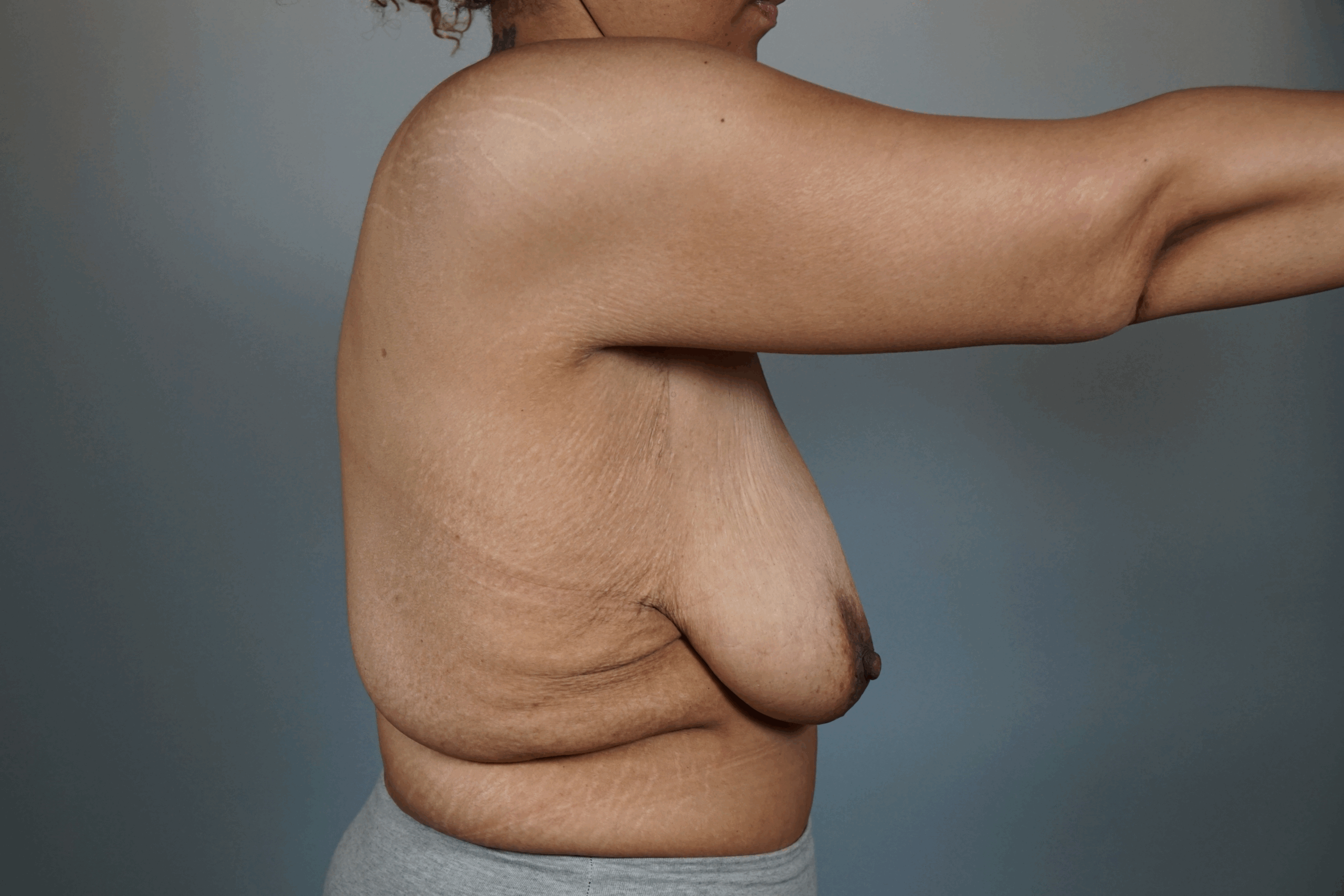 Case #690 Before image