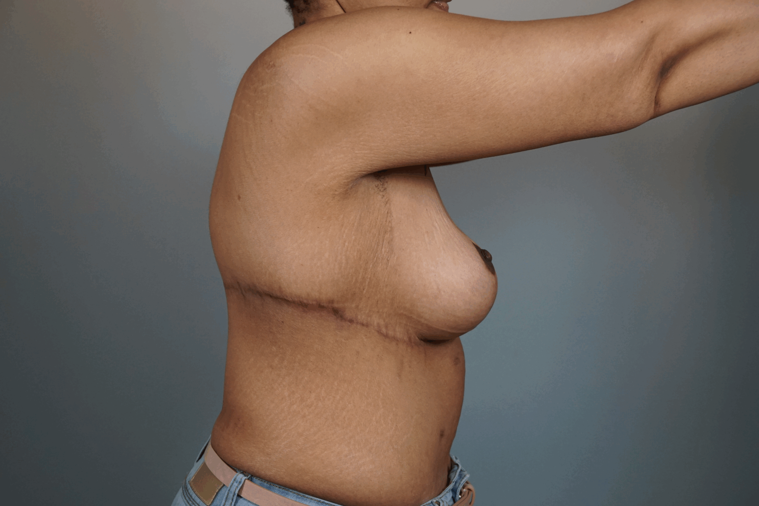 Case #690 After image