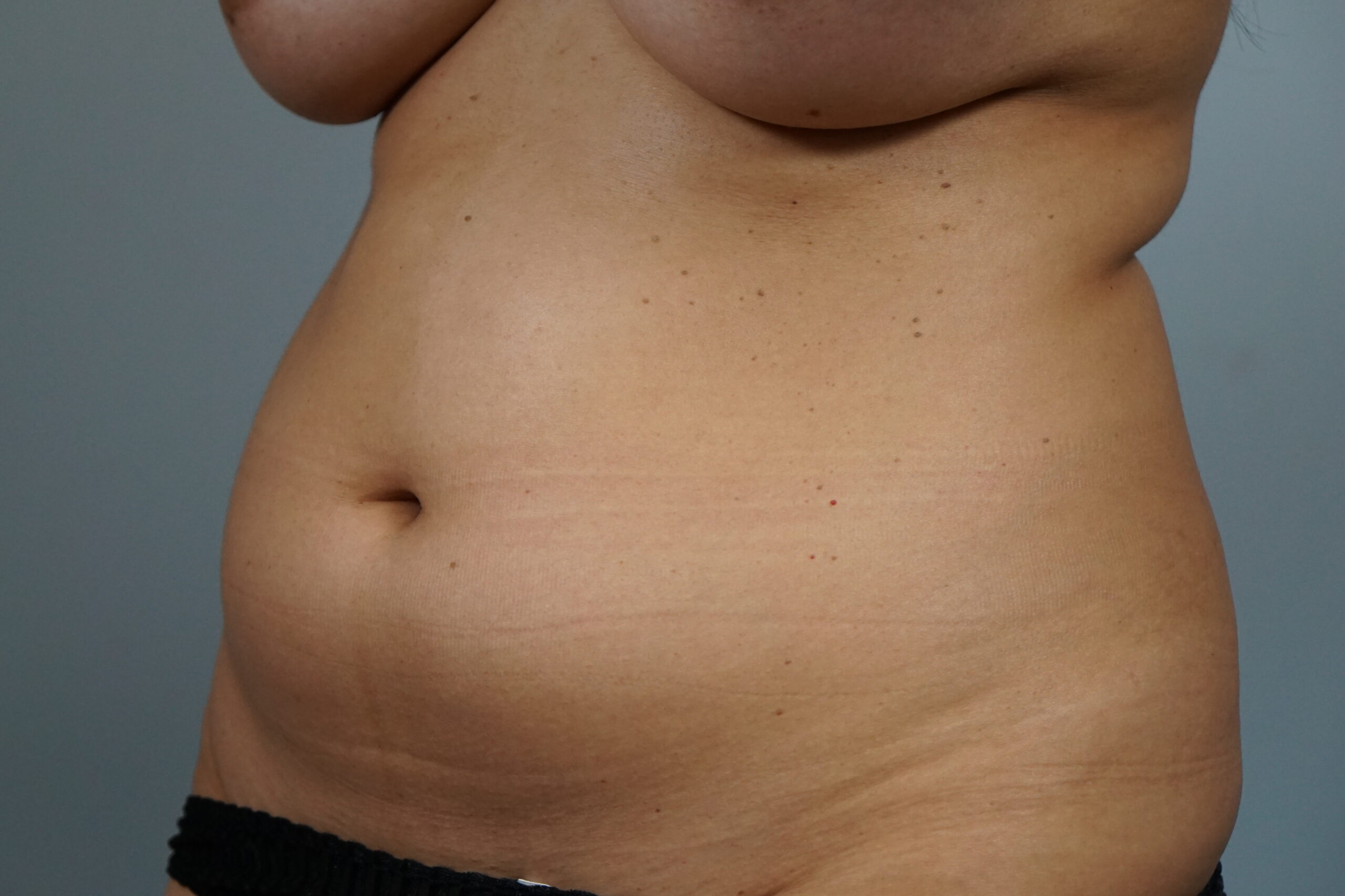 Case #687 Before image