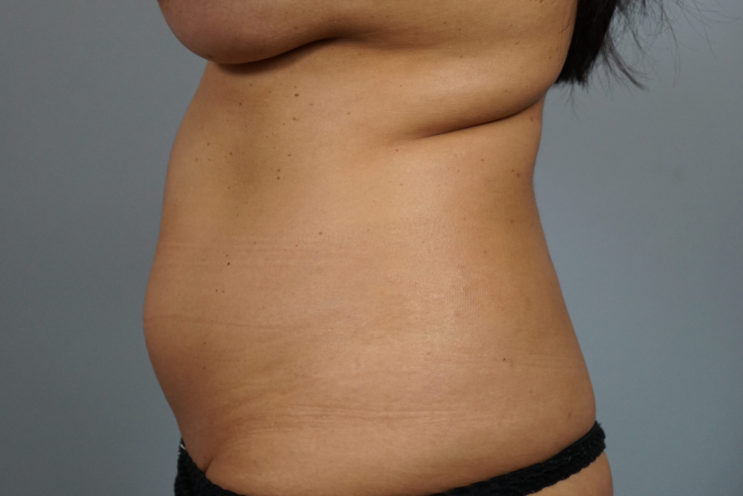 Case #687 Before image