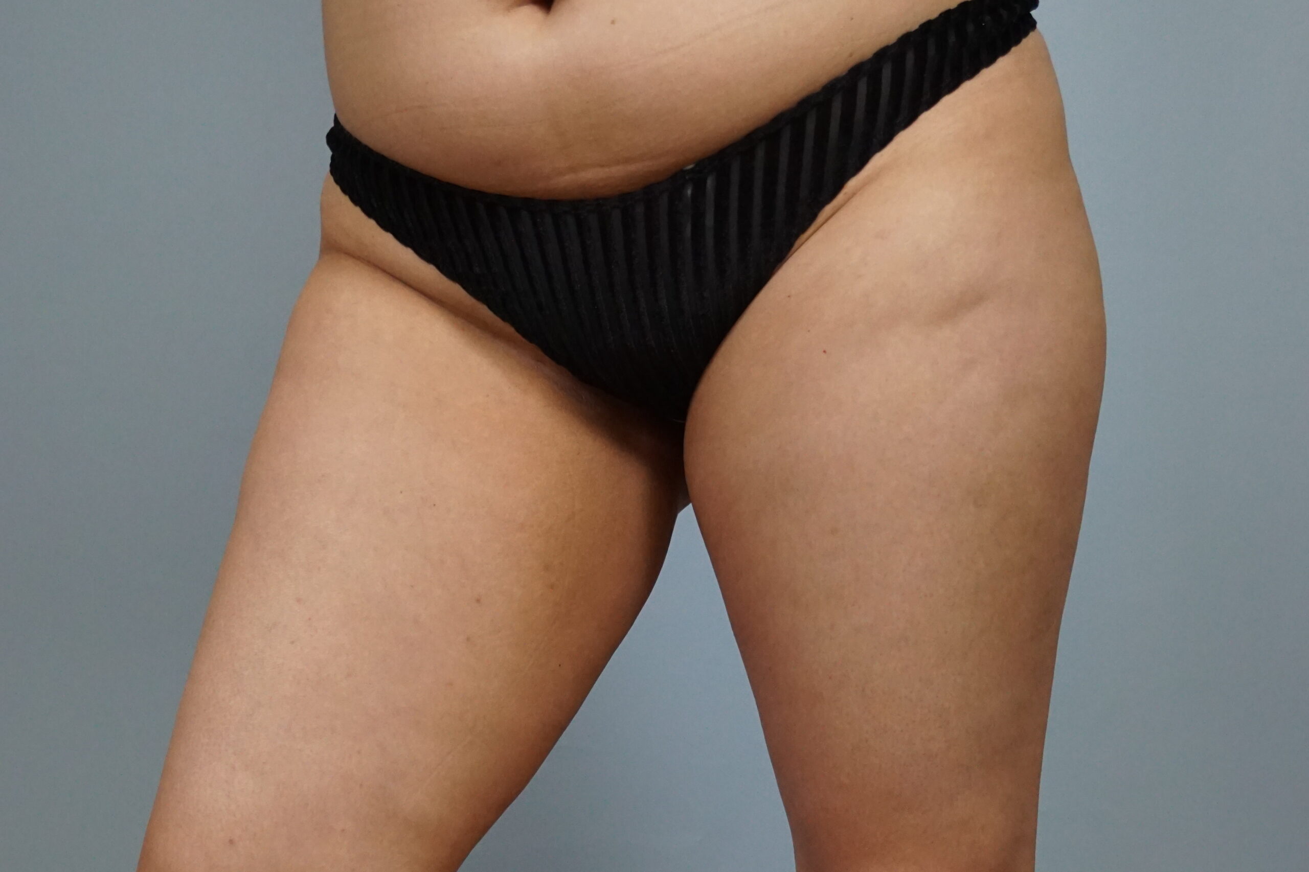 Case #687 Before image