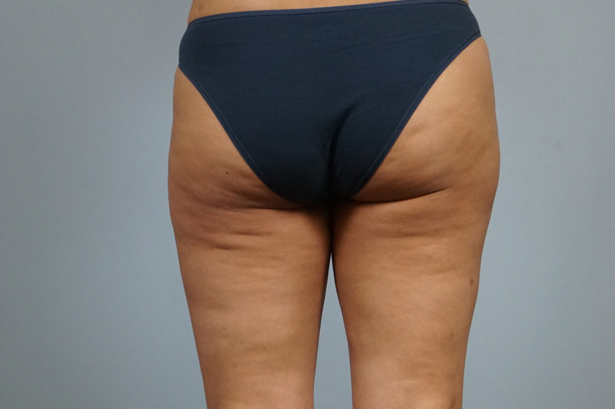 Case #687 After image