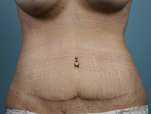 Case #680 After image