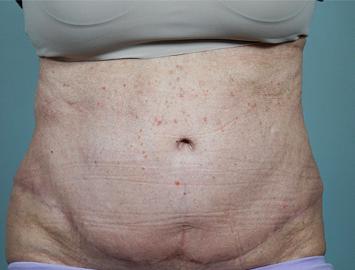 Case #682 After image