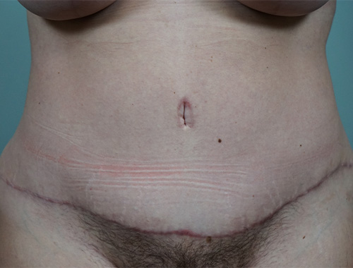 Case #693 After image