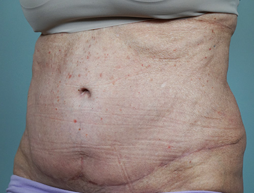 Case #682 After image