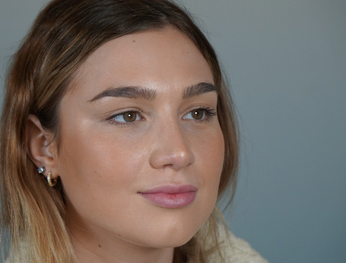 Case #689 After image