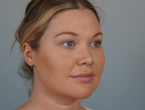 Case #696 After image