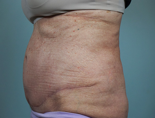 Case #682 After image