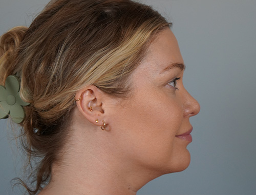 Case #696 After image