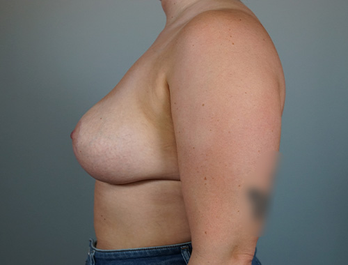 Case #697 After image