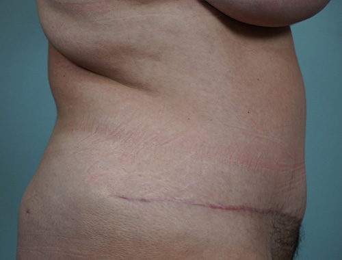 Case #693 After image