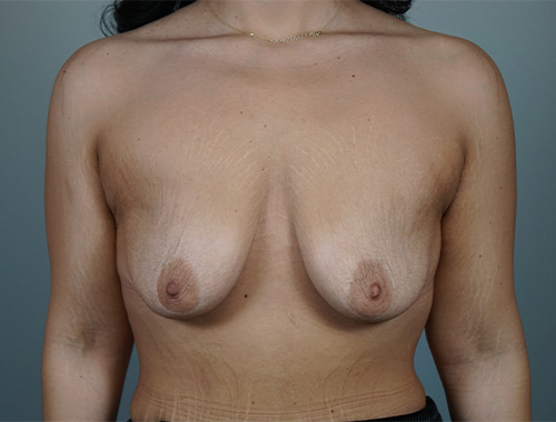 Case #685 Before image