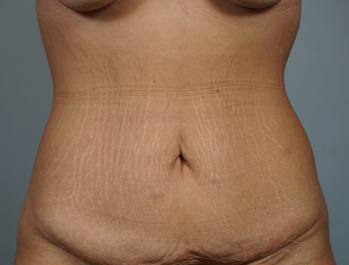 Case #680 Before image